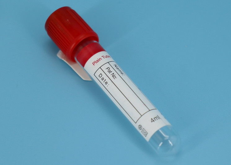 Le fiale criogeniche dell'urina e del sangue trasportano il corredo ambientale medico del corredo/laboratorio
